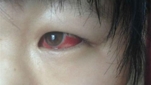 光觸媒除甲醛保護(hù)新裝修教室空氣，更保護(hù)孩子們